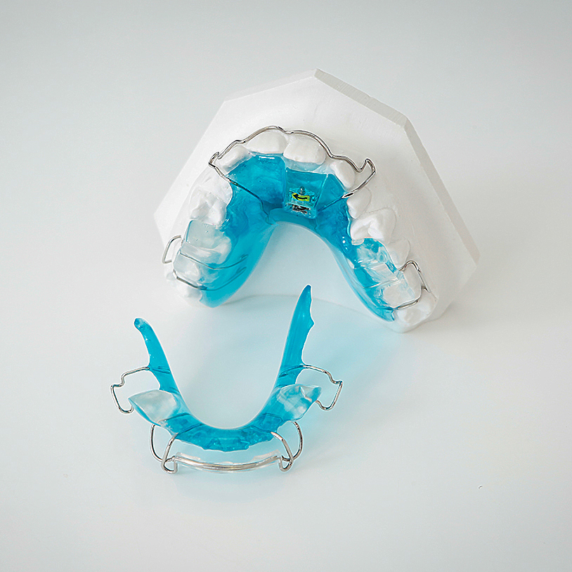 herausnehmbare Spangen - KiO4U – Ihre Zahnarztpraxis in Gera